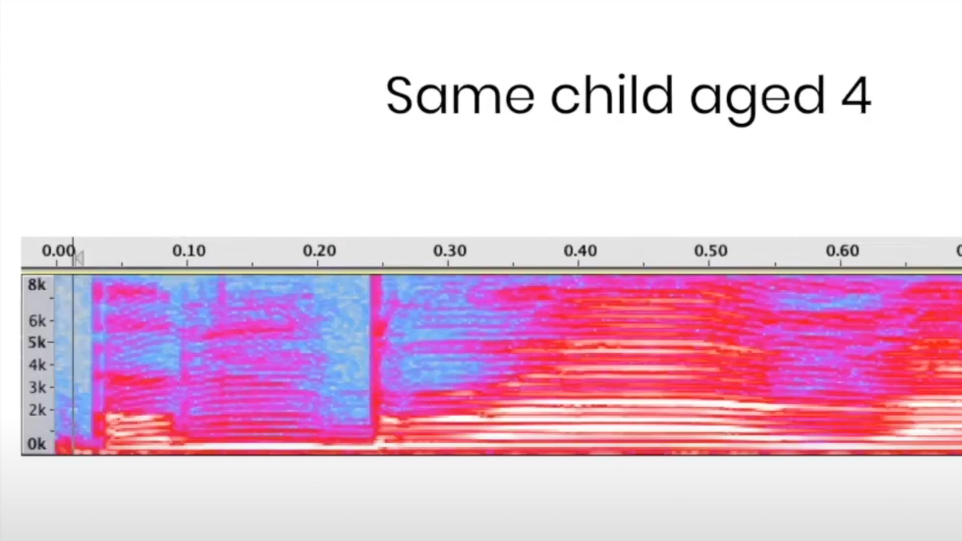 how-voices-change-with-age-soapbox-labs